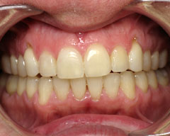 Orthodontic Treatment Case Study