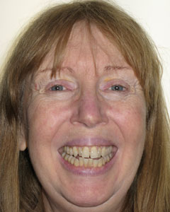 Orthodontic Treatment Case Study