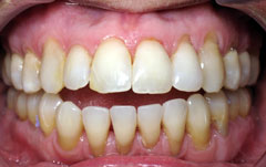 Orthodontic Treatment Case Study