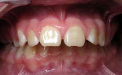 Orthodontic Treatment Case Study