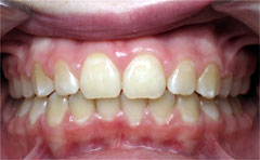 Orthodontic Treatment Case Study