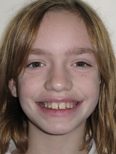 Orthodontic Treatment Case Study
