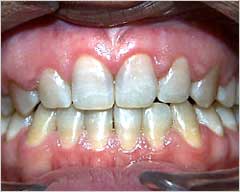 Orthodontic Treatment Case Study