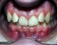 Orthodontic Treatment Case Study