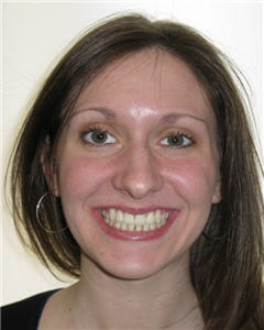 Orthodontic Treatment Case Study