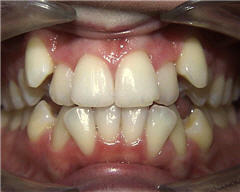 Orthodontic Treatment Case Study