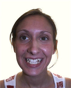 Orthodontic Treatment Case Study