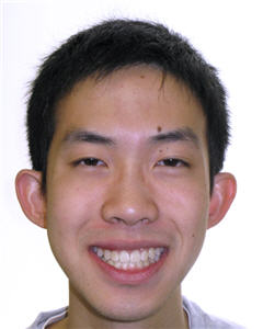 Orthodontic Treatment Case Study