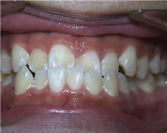 Orthodontic Treatment Case Study