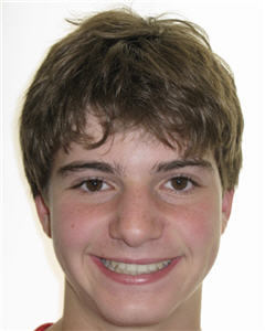 Orthodontic Treatment Case Study