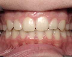 Orthodontic Treatment Case Study