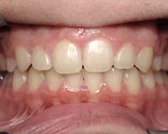 Orthodontic Treatment Case Study