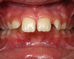 Orthodontic Treatment Case Study