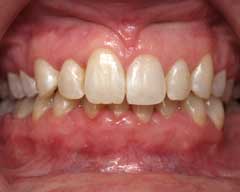 Orthodontic Treatment Case Study