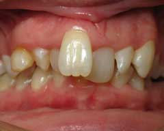 Orthodontic Treatment Case Study