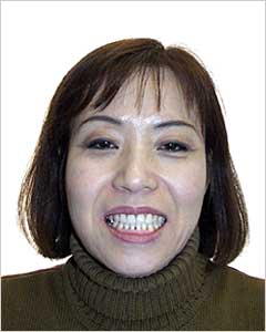 Orthodontic Treatment Case Study