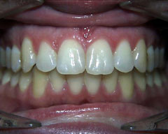 Orthodontic Treatment Case Study