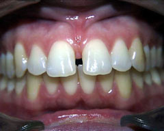 Orthodontic Treatment Case Study