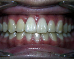 Orthodontic Treatment Case Study