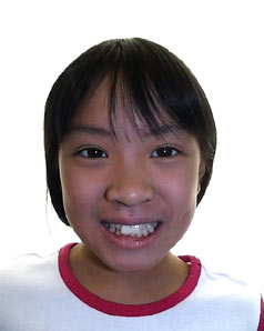 Orthodontic Treatment Case Study