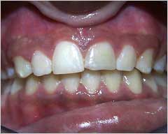 Orthodontic Treatment Case Study