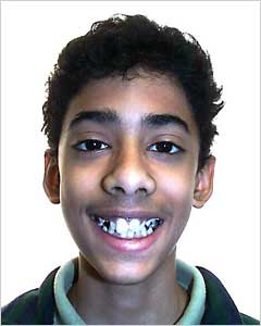 Orthodontic Treatment Case Study