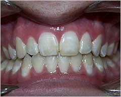 Orthodontic Treatment Case Study