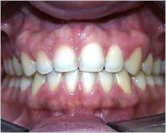 Orthodontic Treatment Case Study