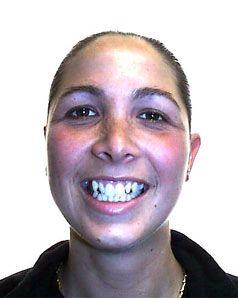 Orthodontic Treatment Case Study