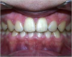 Orthodontic Treatment Case Study