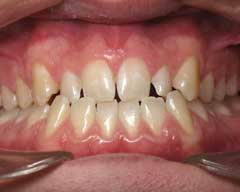 Orthodontic Treatment Case Study