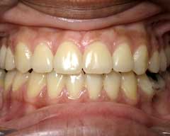Orthodontic Treatment Case Study