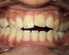 Orthodontic Treatment Case Study