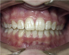 Orthodontic Treatment Case Study