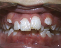 Orthodontic Treatment Case Study