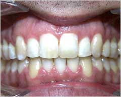 Orthodontic Treatment Case Study