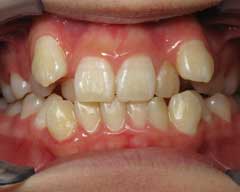 Orthodontic Treatment Case Study