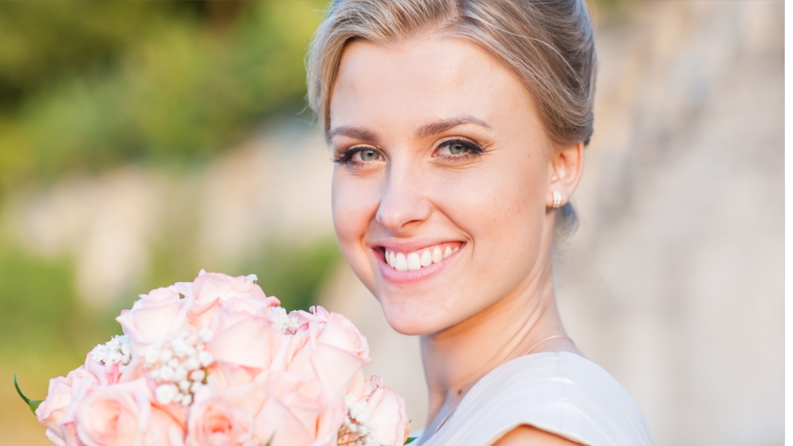 engagement invisalign special
