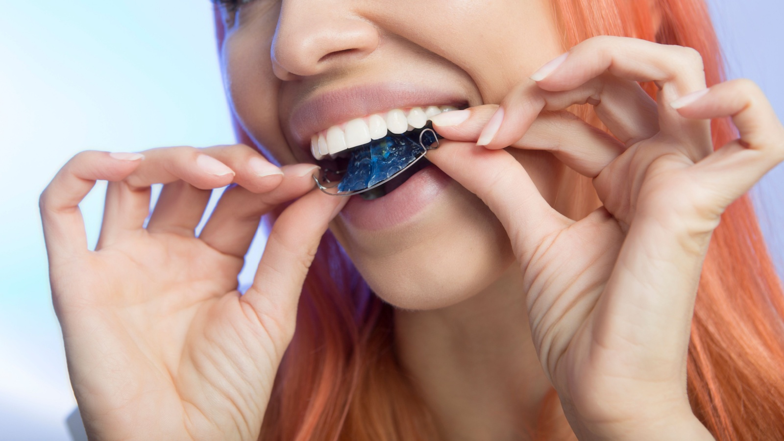 retainer after braces