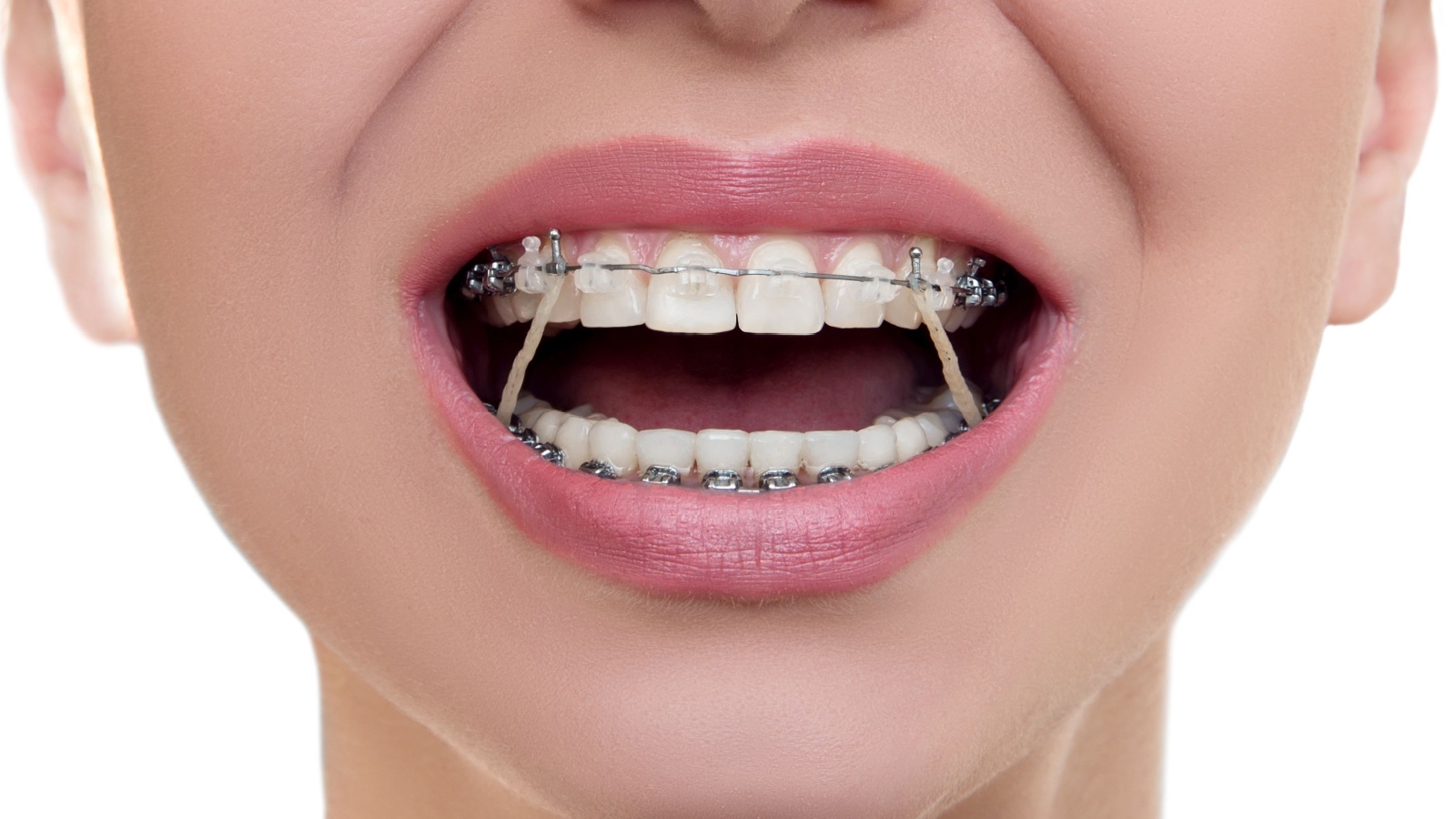 ELASTICS