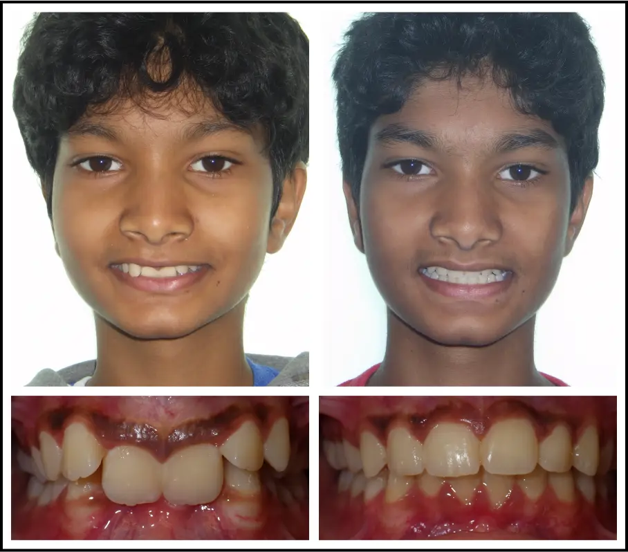 Akhil